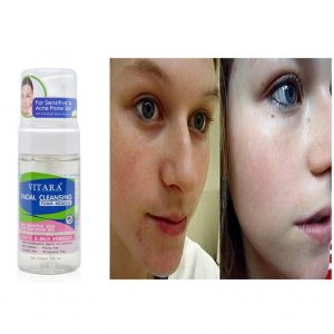 Bọt Rửa Mặt Làm Sạch Da Mụn Và Da Nhạy Cảm Vitara Facial Cleansing Foam Mouse 2